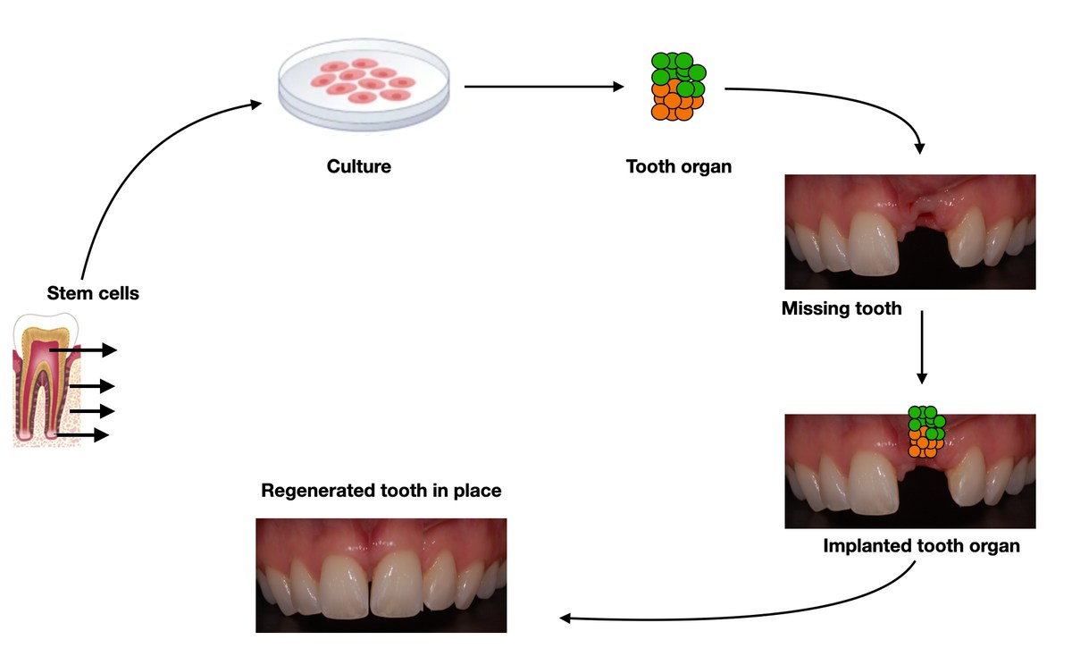 First bioengineered tooth germ